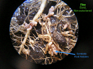 Plant Symbiotic Root Nodules